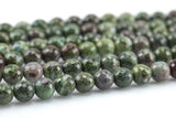 Natural Ruby Caldrite- Faceted Round- 6mm, 8mm, 10mm Gemstone Beads